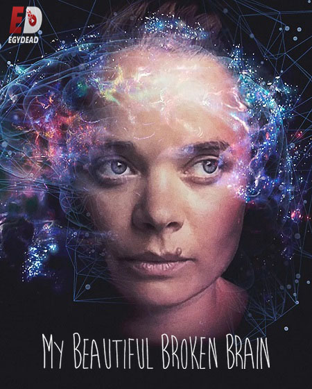 مشاهدة فيلم My Beautiful Broken Brain 2014 مترجم